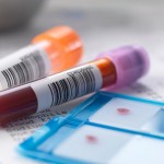 Blood and urine samples with medical results